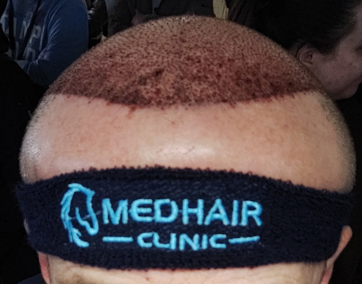 /foren/transplant/index.php/fa/68486/0/