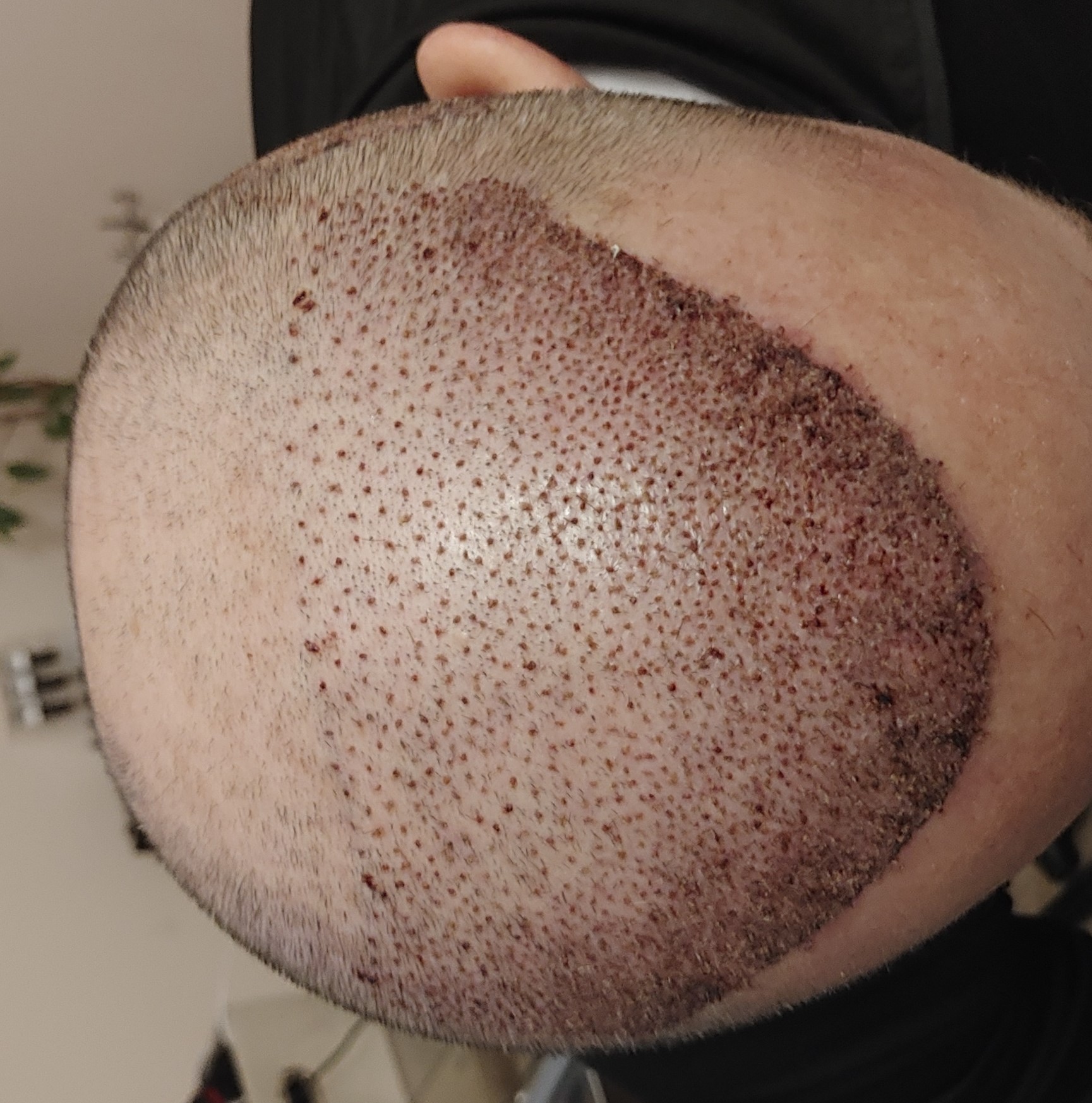 /foren/transplant/index.php/fa/68487/0/