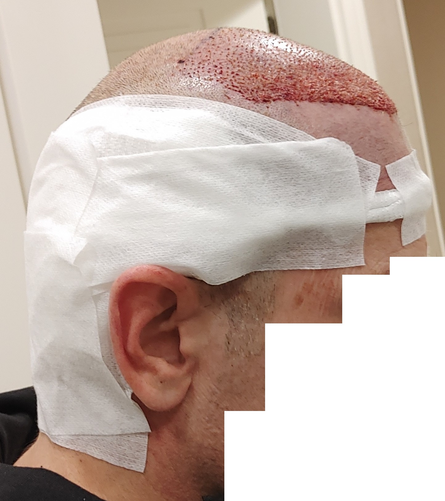 /foren/transplant/index.php/fa/68488/0/