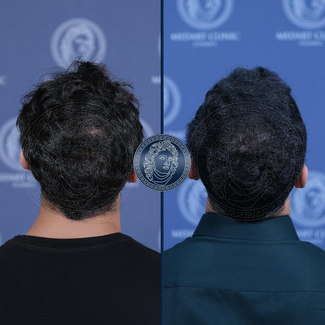 /foren/transplant/index.php/fa/68544/0/