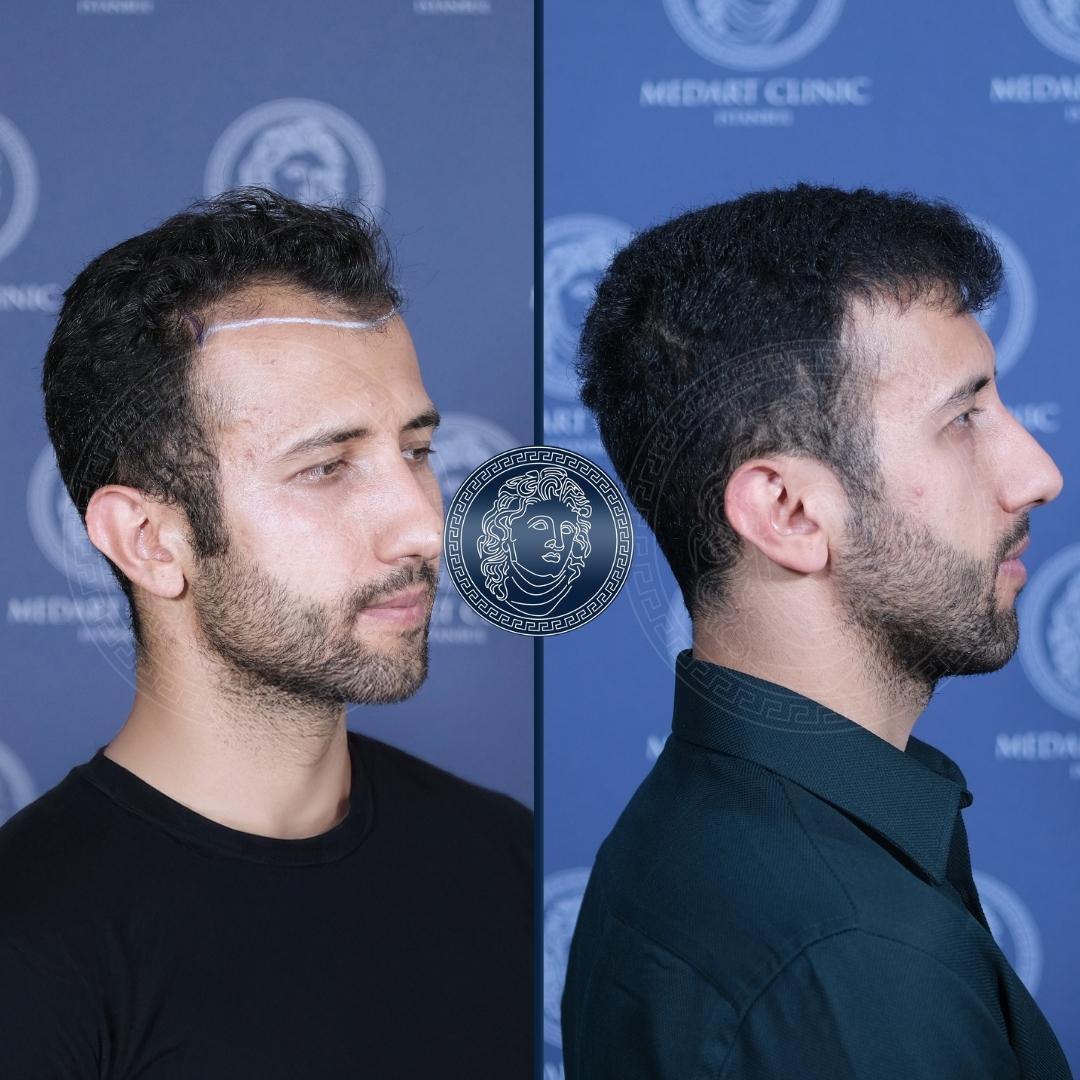 /foren/transplant/index.php/fa/68545/0/