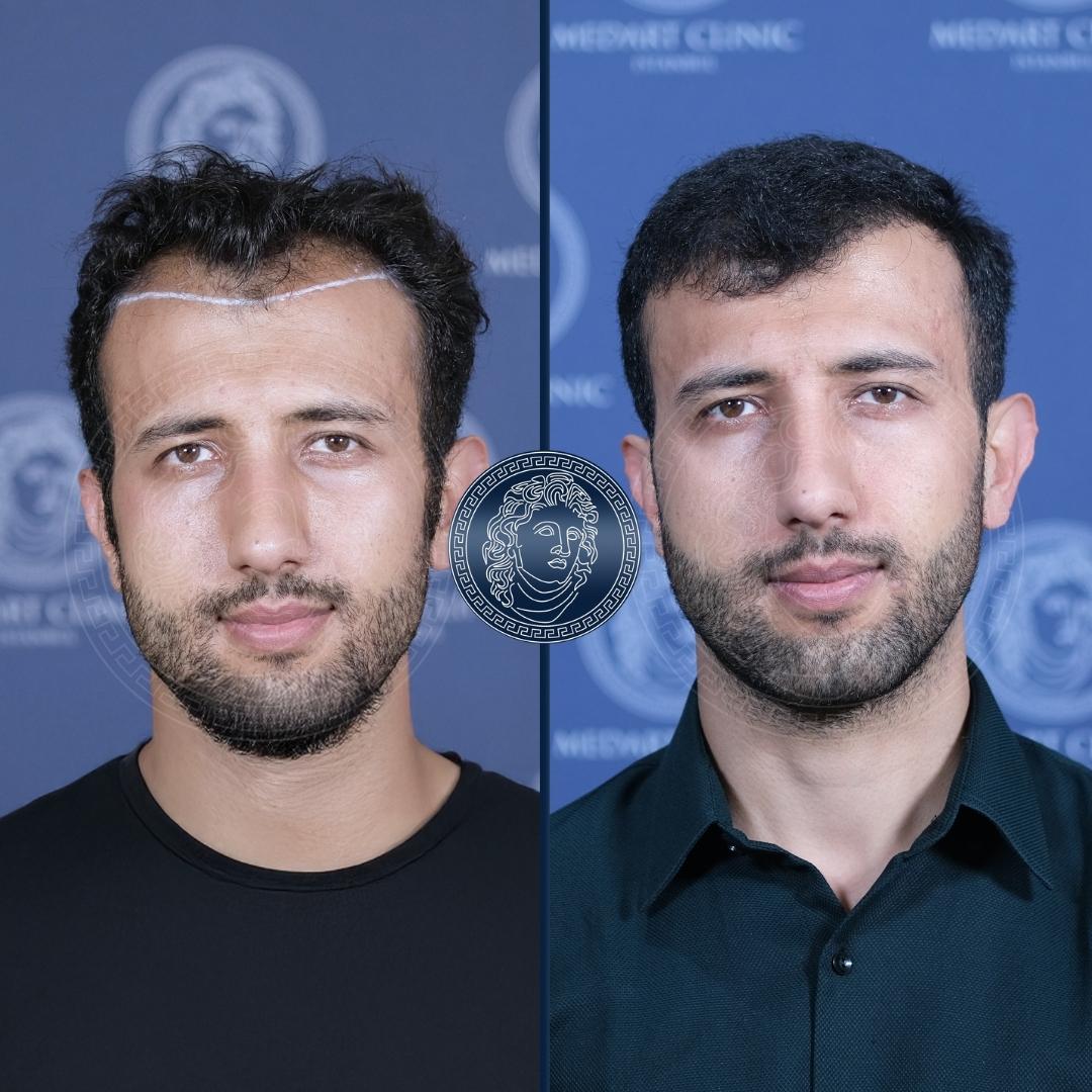 /foren/transplant/index.php/fa/68546/0/