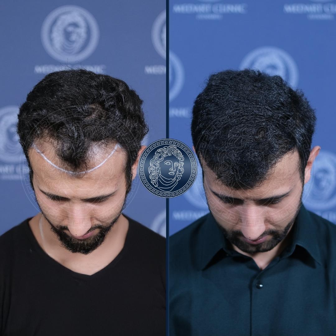 /foren/transplant/index.php/fa/68547/0/