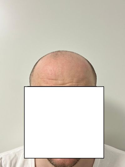 /foren/transplant/index.php/fa/68636/0/