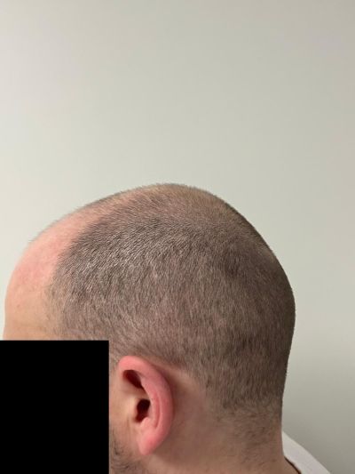 /foren/transplant/index.php/fa/68637/0/