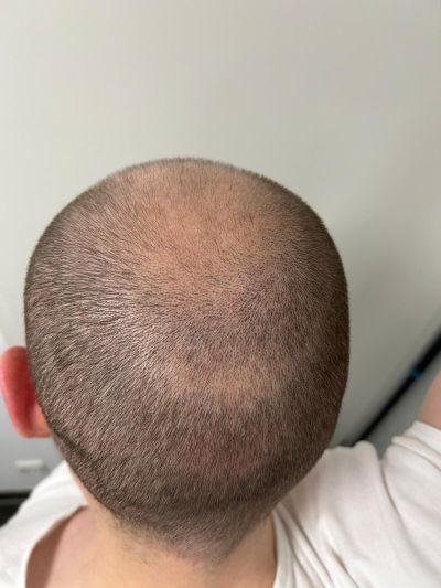 /foren/transplant/index.php/fa/68638/0/