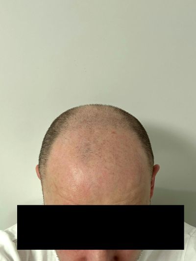 /foren/transplant/index.php/fa/68639/0/