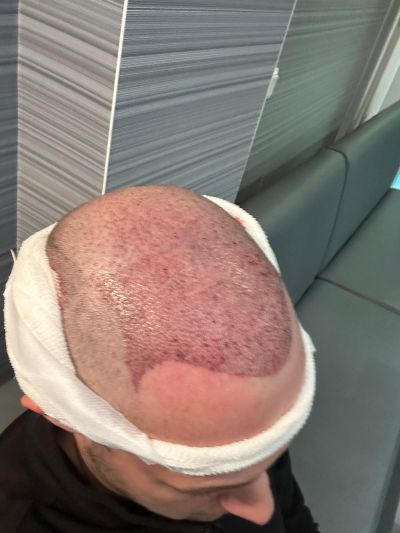 /foren/transplant/index.php/fa/68640/0/