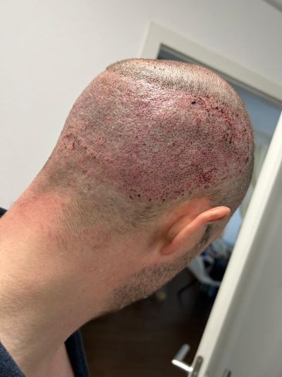 /foren/transplant/index.php/fa/68641/0/