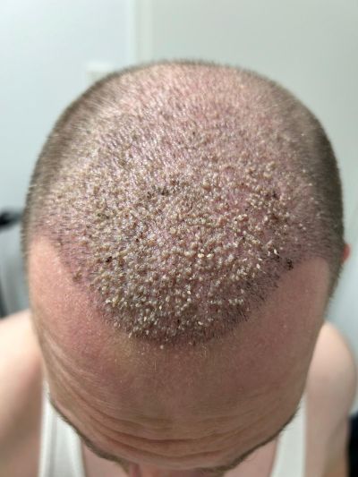 /foren/transplant/index.php/fa/68642/0/