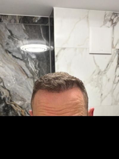 /foren/transplant/index.php/fa/68648/0/