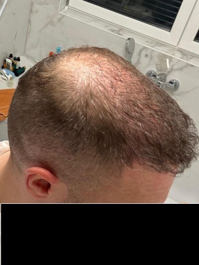 /foren/transplant/index.php/fa/68649/0/