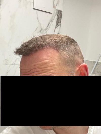 /foren/transplant/index.php/fa/68650/0/