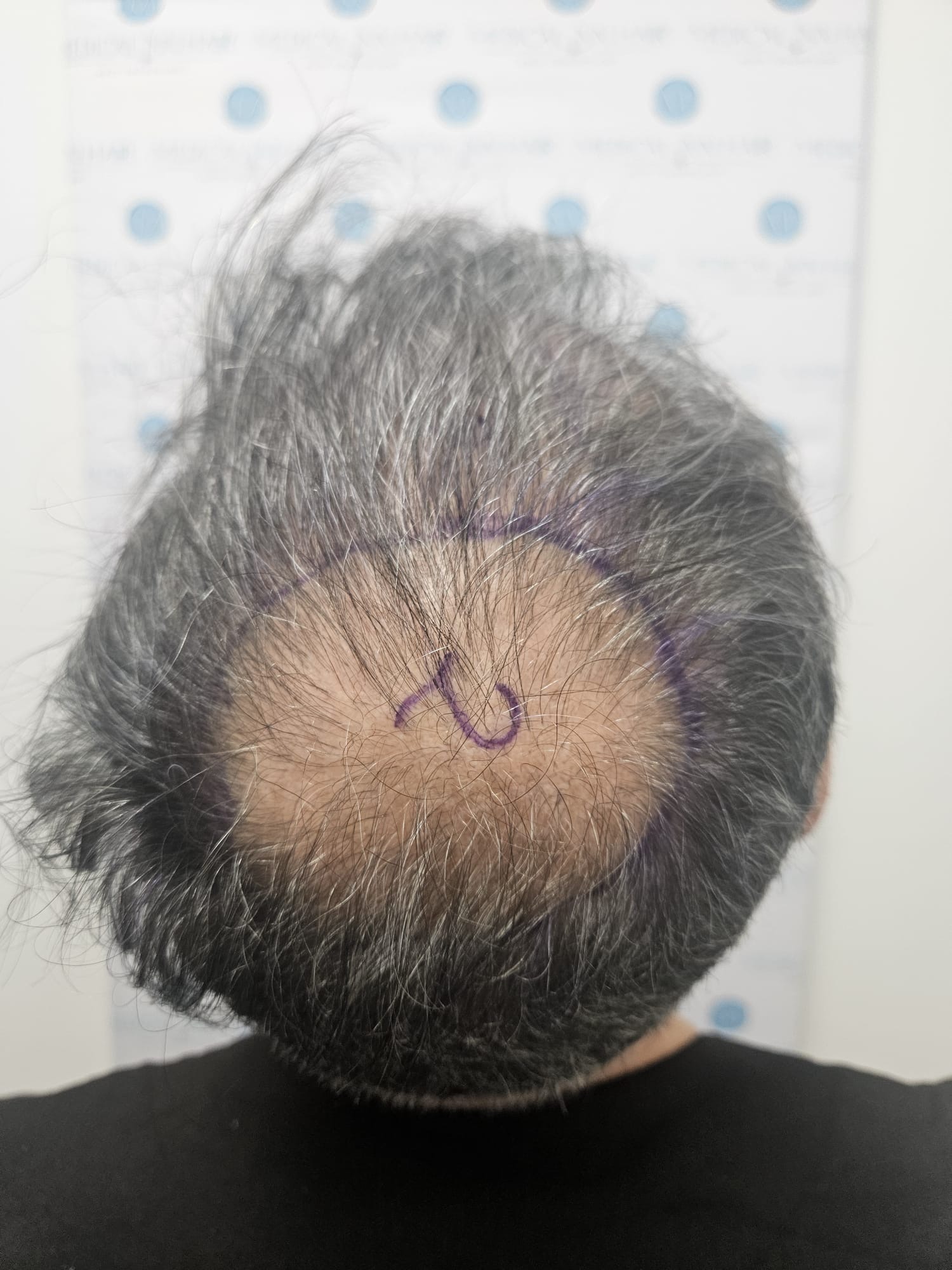 /foren/transplant/index.php/fa/68676/0/