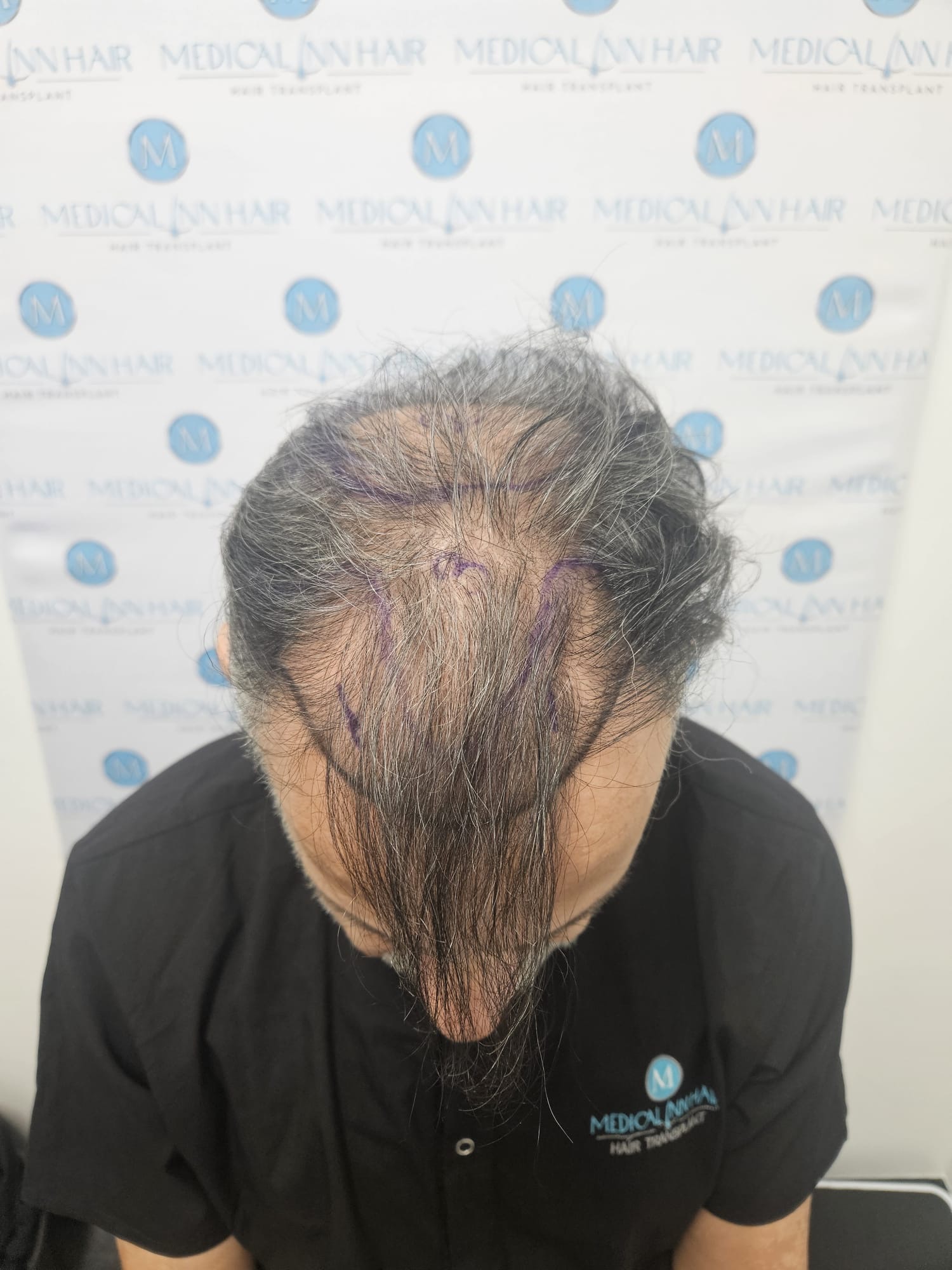 /foren/transplant/index.php/fa/68677/0/