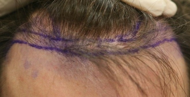 index.php/fa/7105/0/