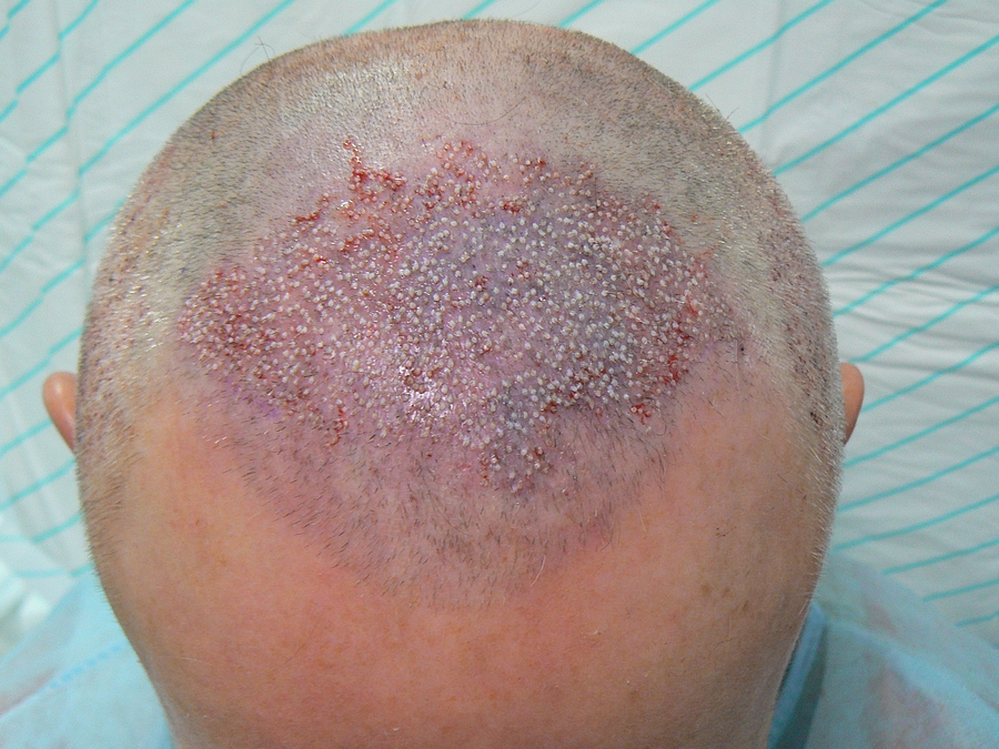 index.php/fa/8194/0/