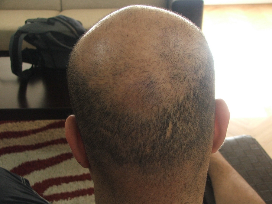 index.php/fa/8555/0/