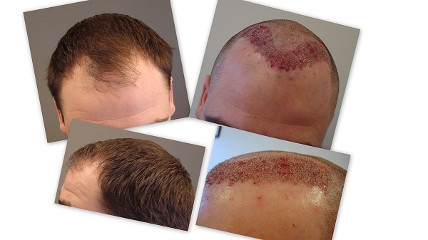 index.php/fa/8690/0/