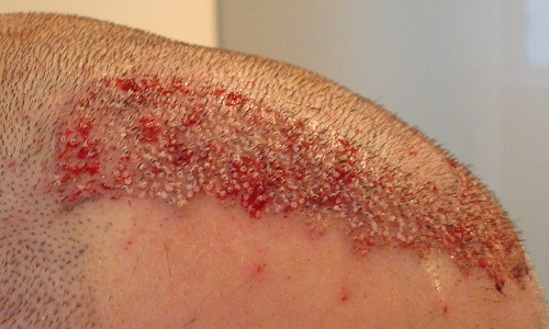 index.php/fa/8691/0/