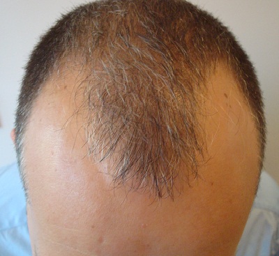 index.php/fa/8935/0/