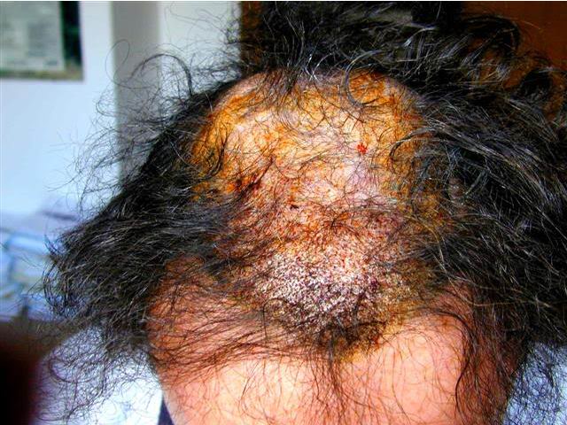 index.php/fa/8976/0/