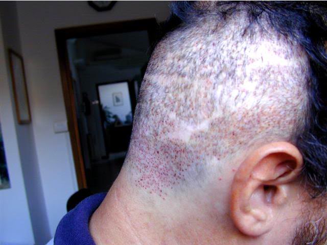 index.php/fa/8978/0/