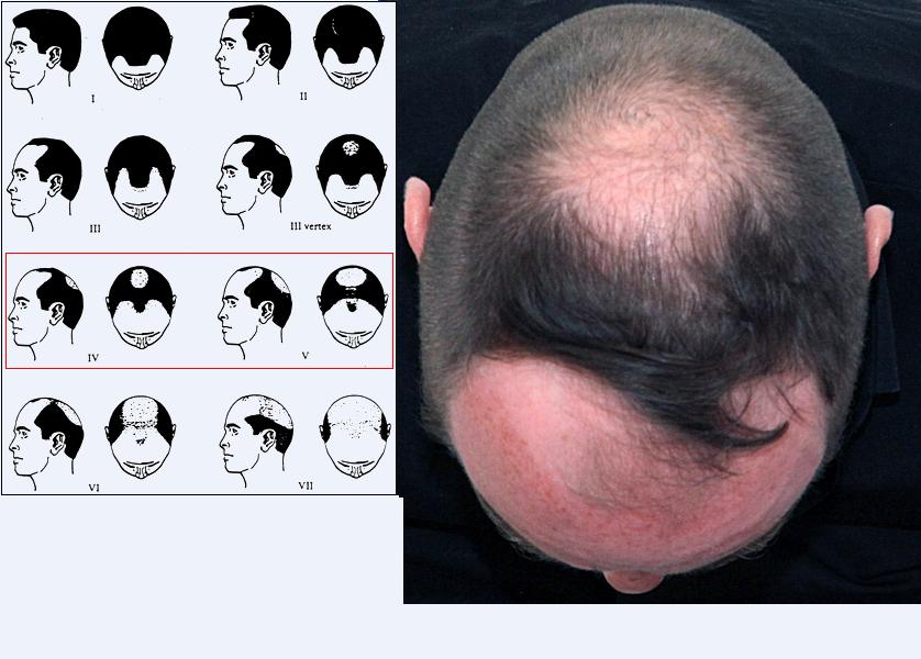 index.php/fa/9030/0/