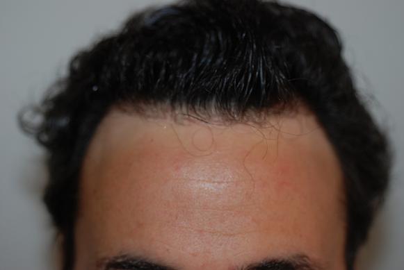 index.php/fa/9320/0/