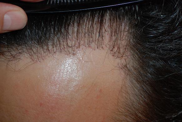 index.php/fa/9321/0/