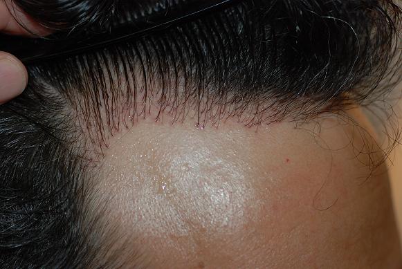 index.php/fa/9322/0/