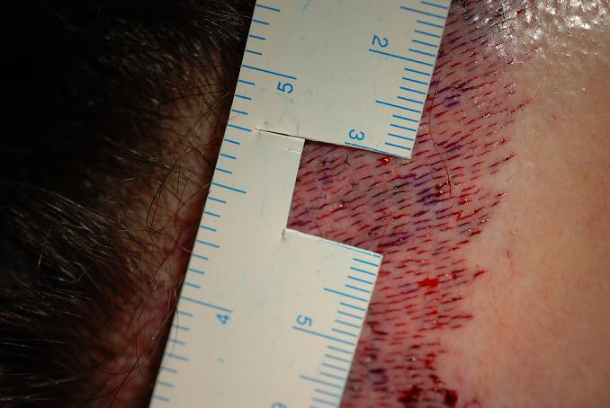 index.php/fa/9331/0/