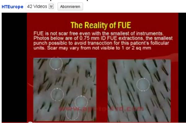 index.php/fa/9393/0/