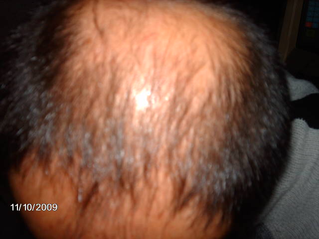 index.php/fa/9527/0/