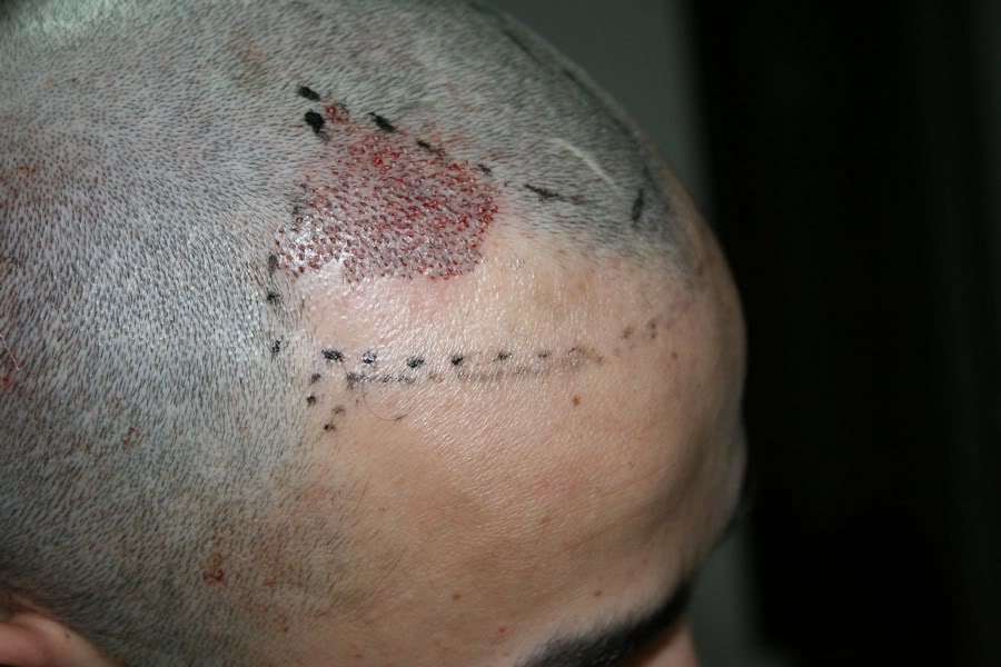 index.php/fa/9667/0/