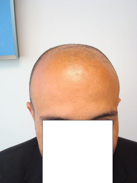 index.php/fa/9987/0/