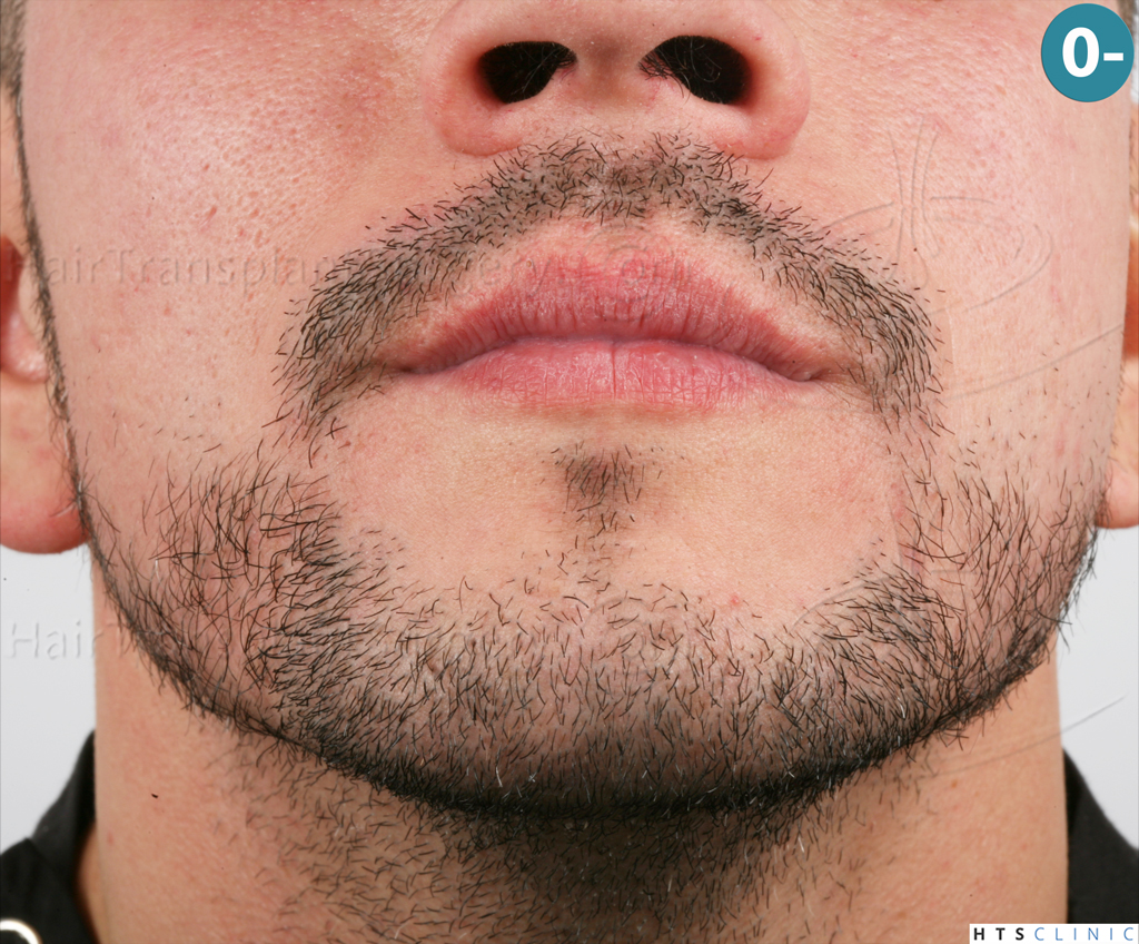 /foren/transplant/index.php?t=getfile&id=38790&private=0