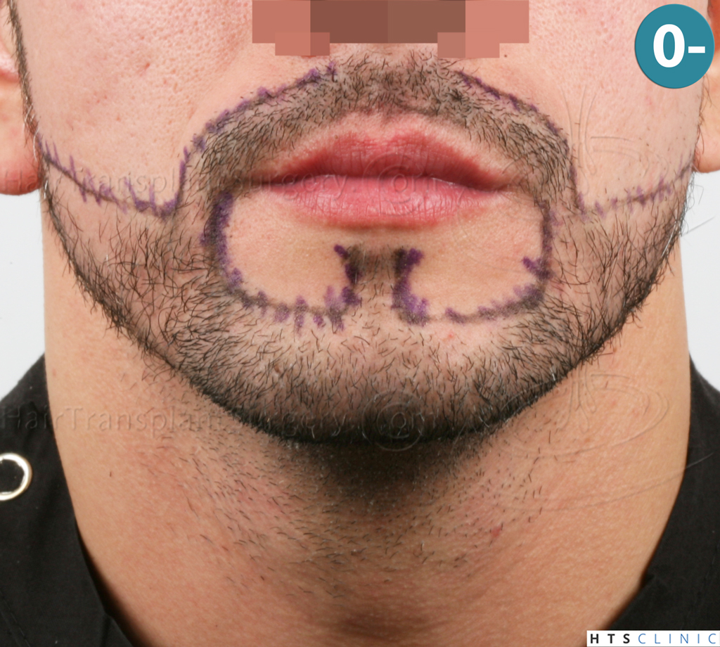 /foren/transplant/index.php?t=getfile&id=38794&private=0