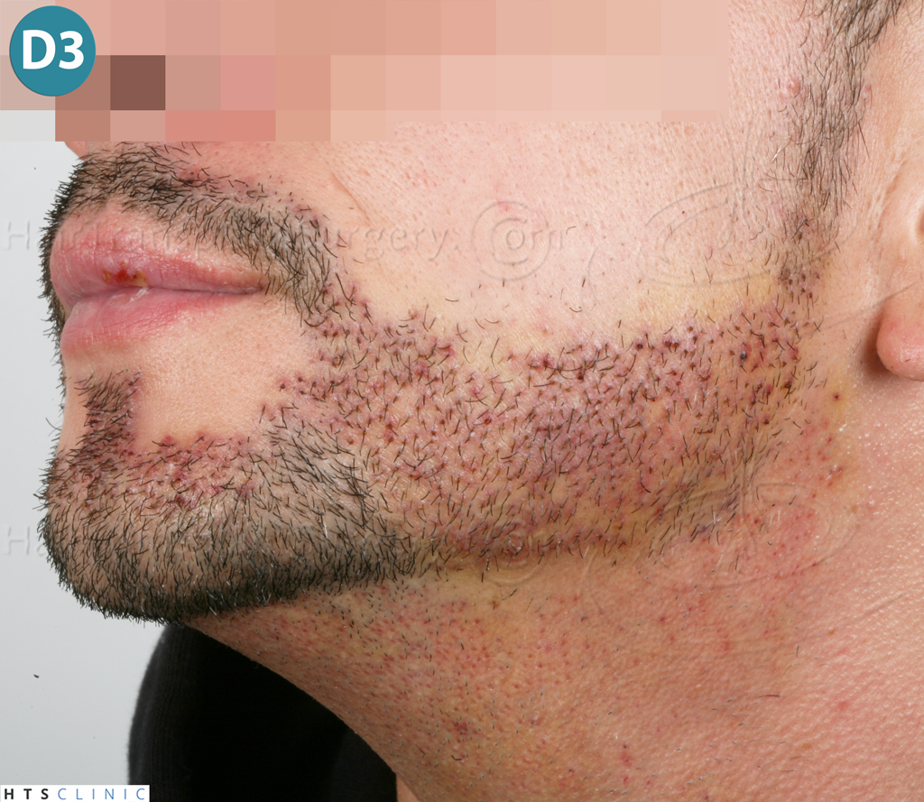 /foren/transplant/index.php?t=getfile&id=38804&private=0