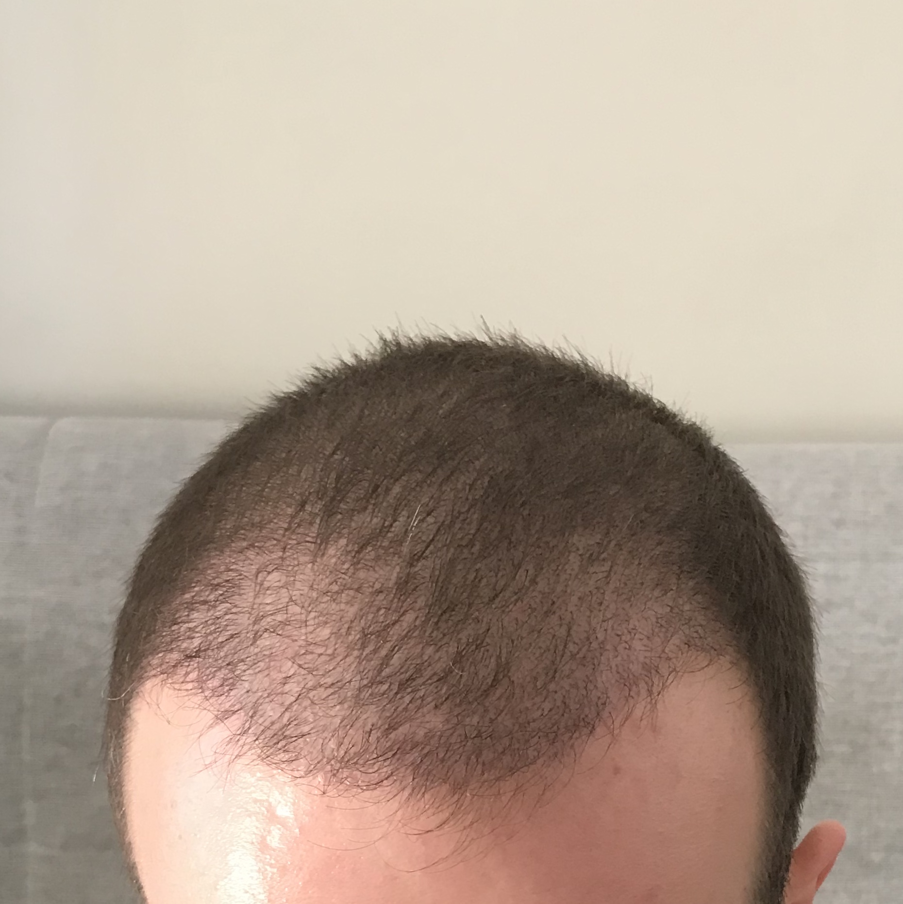 /foren/transplant/index.php?t=getfile&id=38869&private=0