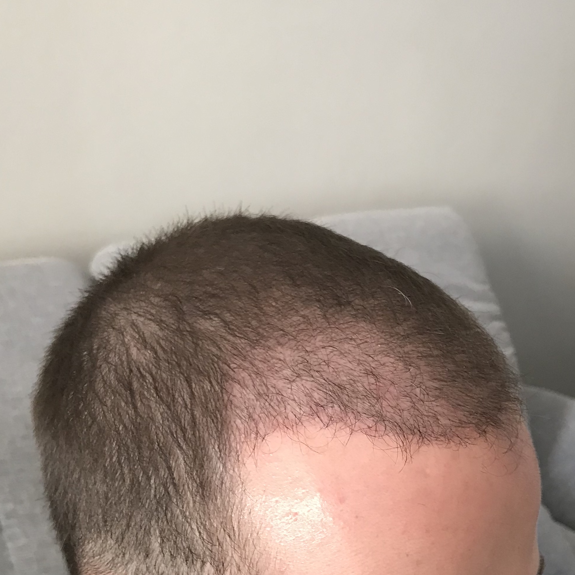 /foren/transplant/index.php?t=getfile&id=38870&private=0