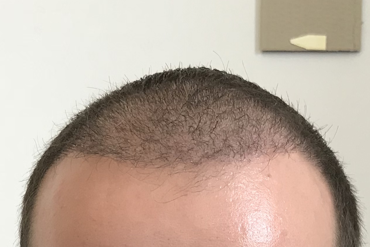 /foren/transplant/index.php?t=getfile&id=38872&private=0