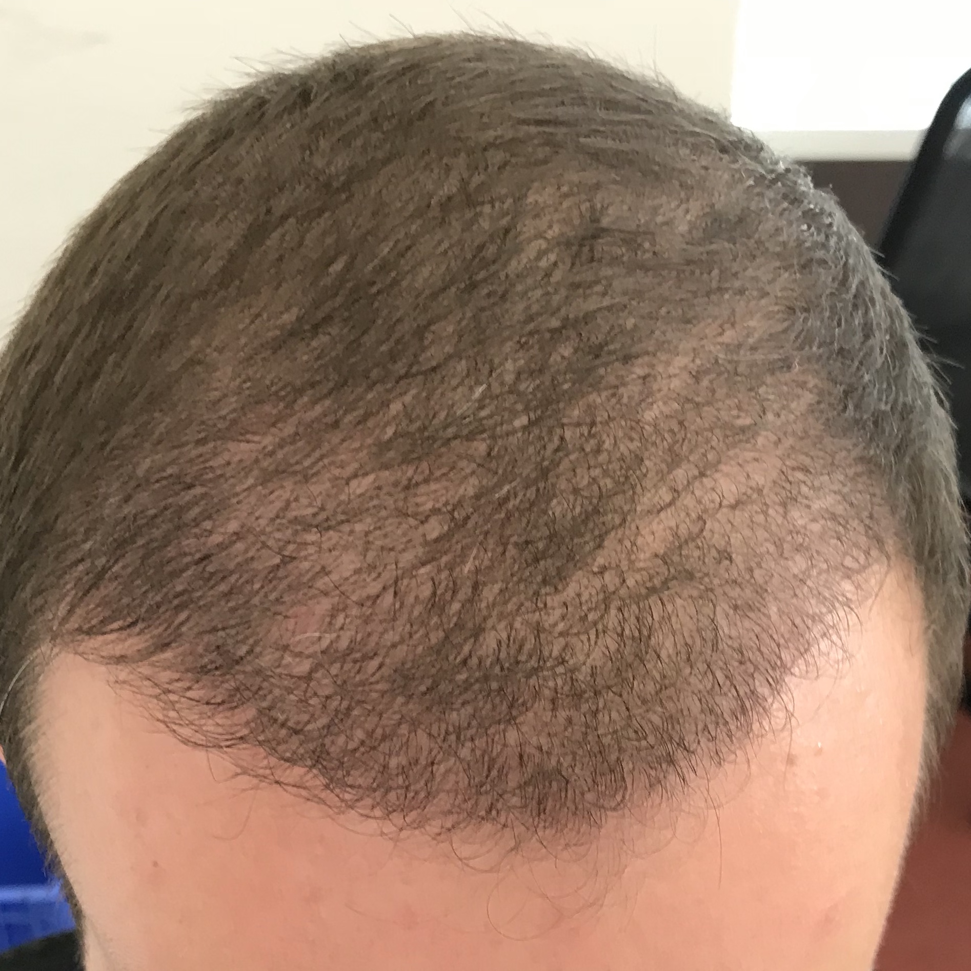 /foren/transplant/index.php?t=getfile&id=38972&private=0