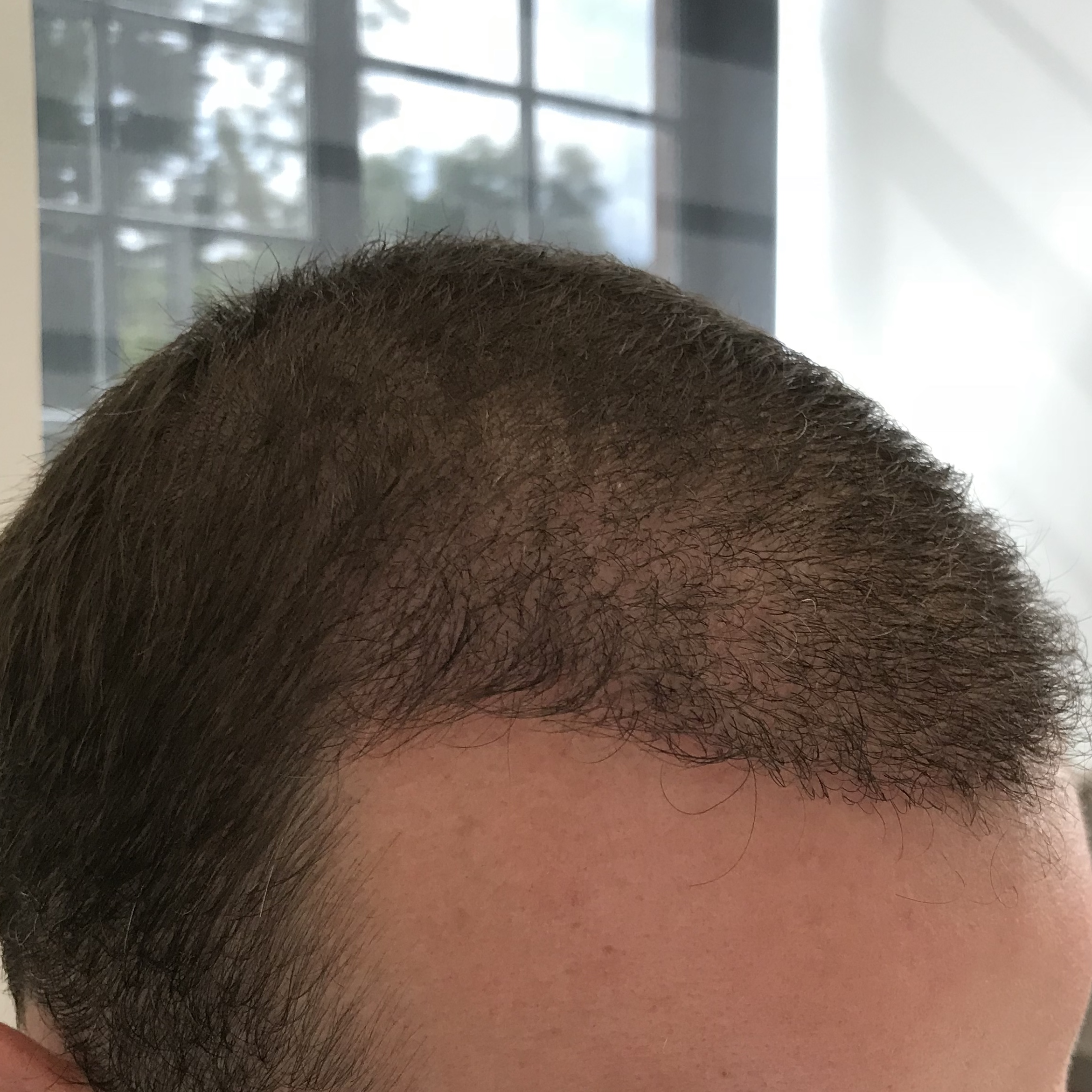 /foren/transplant/index.php?t=getfile&id=38973&private=0