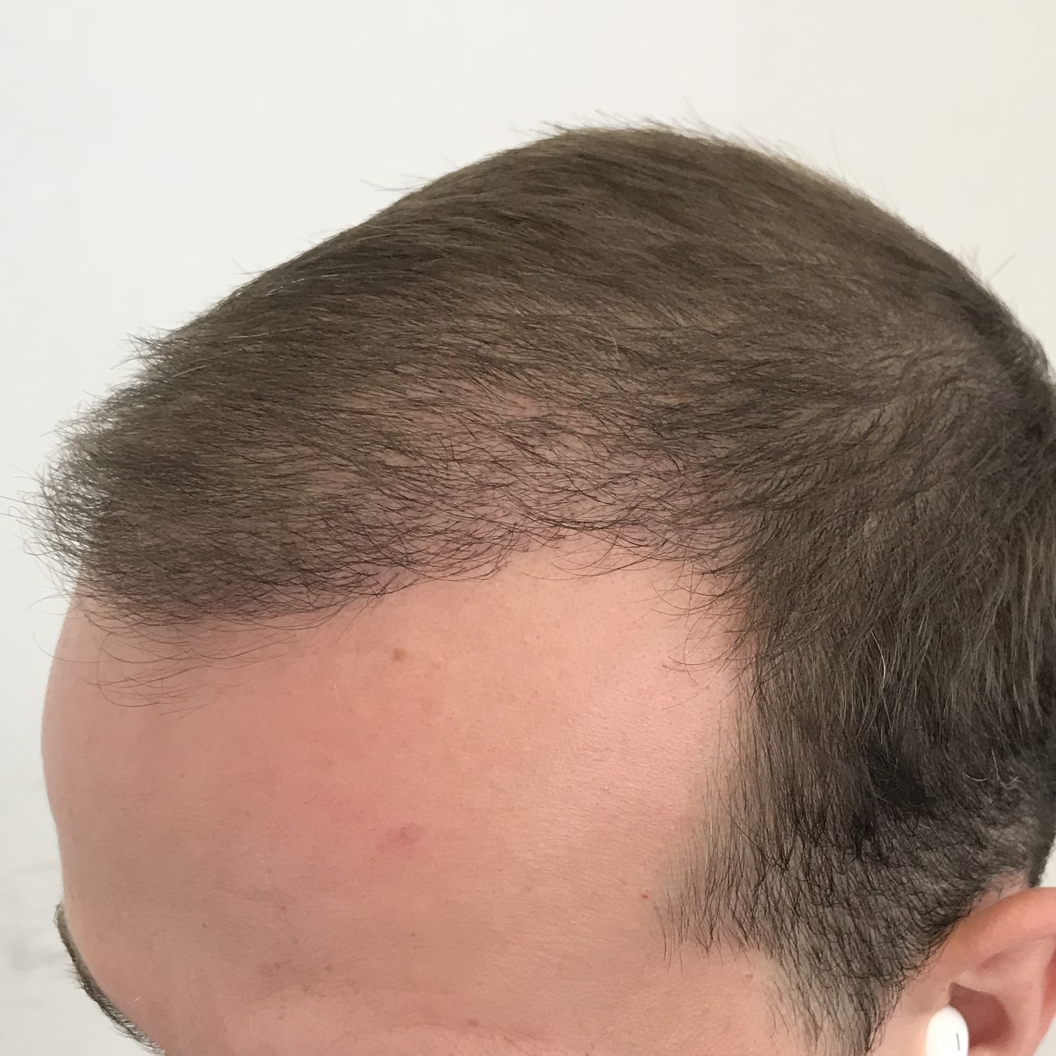 /foren/transplant/index.php?t=getfile&id=38974&private=0