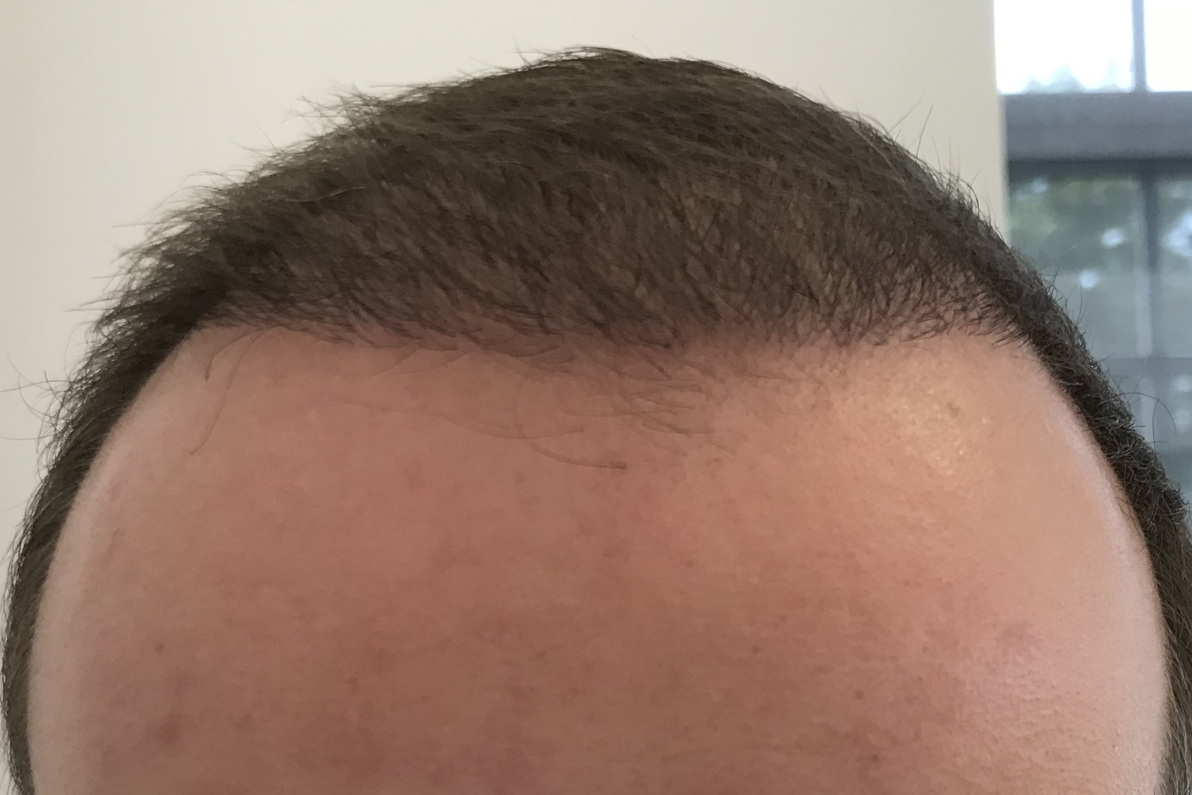 /foren/transplant/index.php?t=getfile&id=38975&private=0