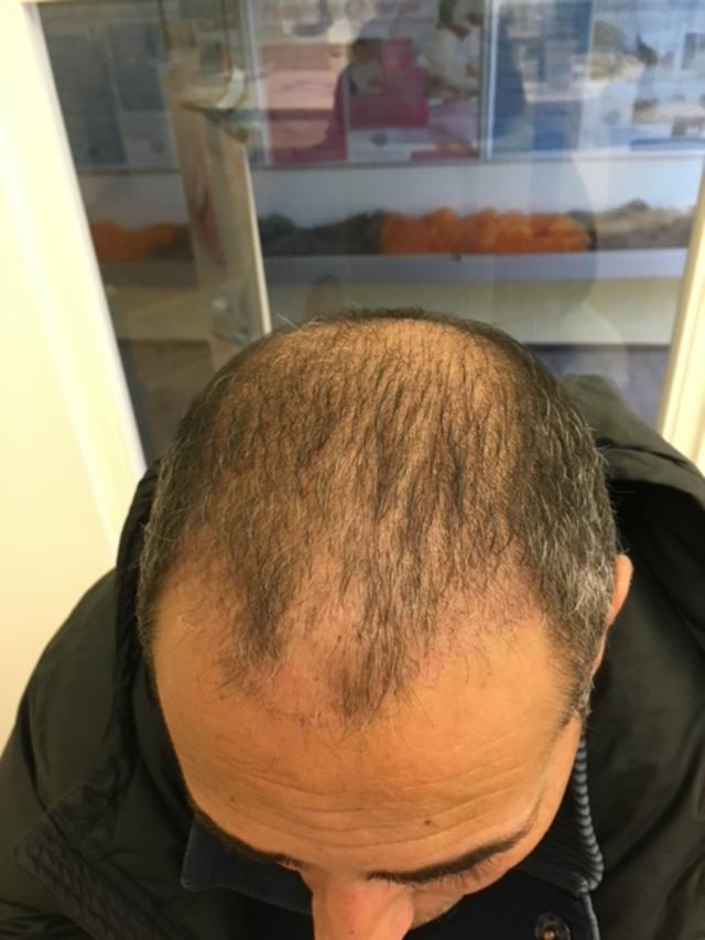 /foren/transplant/index.php?t=getfile&id=38987&private=0