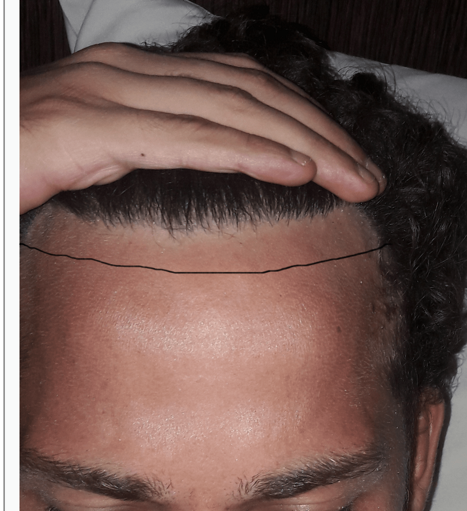 /foren/transplant/index.php?t=getfile&id=38993&private=0