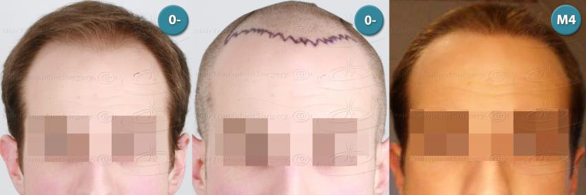 /foren/transplant/index.php?t=getfile&id=39031&private=0