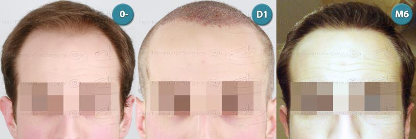 /foren/transplant/index.php?t=getfile&id=39032&private=0